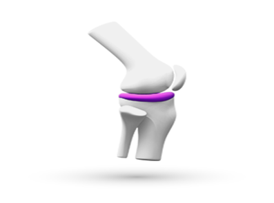 Ρευματοειδής Αρθρίτιδα
